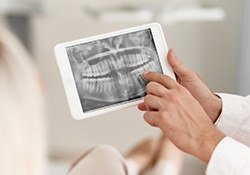 Digital dental x-rays on tablet computer