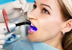 woman undergoing dental bonding procedure
