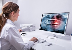 dentist looking at a patient’s X-rays 