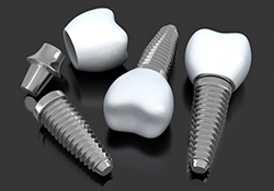 three dental implant posts with abutments and crowns