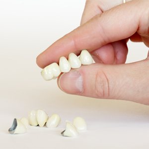 Dental crowns