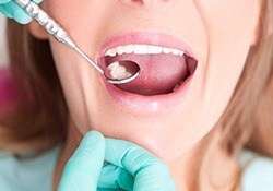 Closeup of smile during dental exam