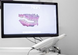 trios intraoral scanner