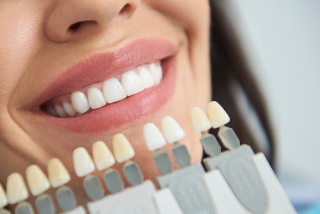 Woman smiling during professional teeth whitening consultation