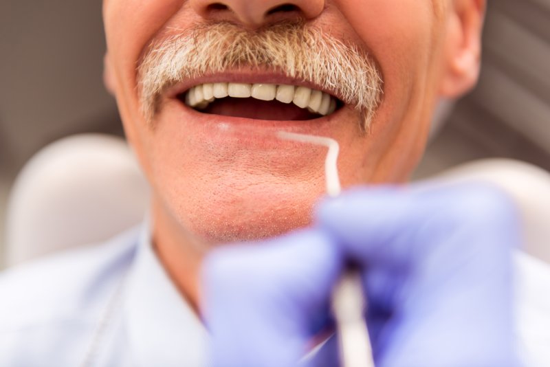 A man getting his implant dentures cleaned due to smoking